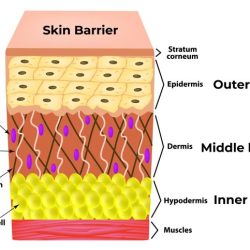 Sebum heimat secretion balance insufficient cracks