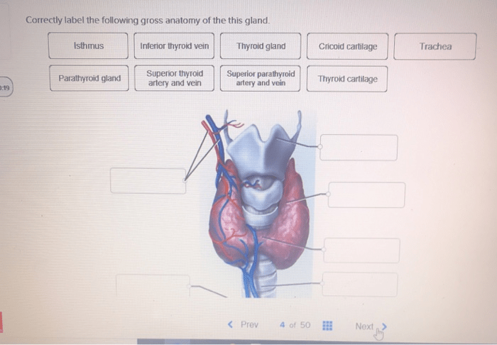 Correctly label the following gross anatomy of the thyroid gland